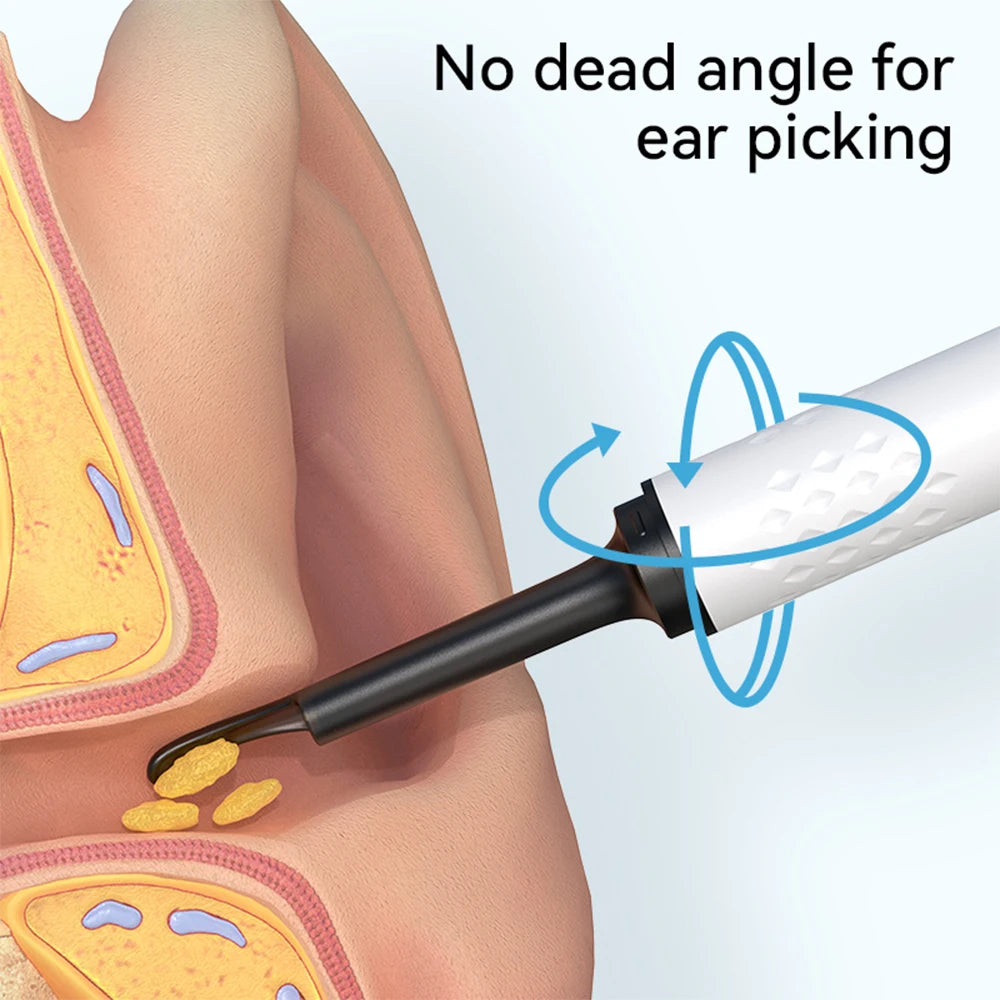 3.5mm Intelligent Visual Ear Pick Portable Ear Cleaning Tool Luminous Endoscope HD Otoscope Ear Picking Spoon Ear Wax Cleaner